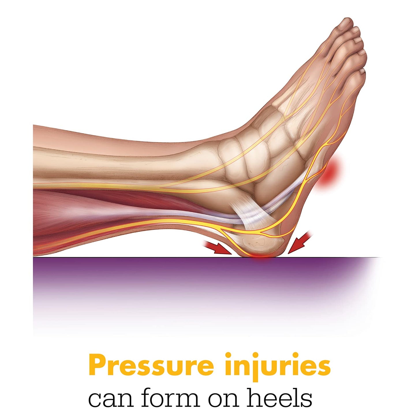 Sage Stryker Prevalon Heel Protector II – 1 Heel Protector – Cushioned Boot for Heel Pressure Relief for Bed-Bound Individuals – Standard Size
